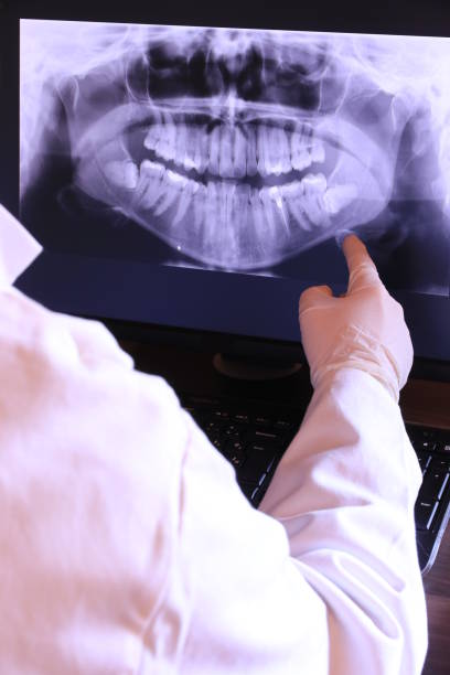 Best Emergency Root Canal Treatment in Hoopa, CA