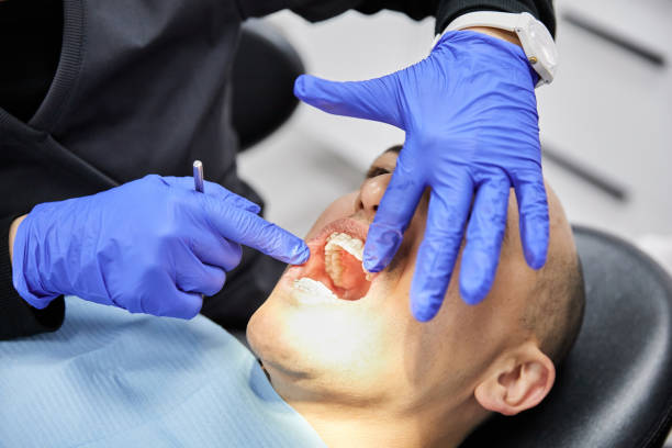 Best Emergency Dental Care for Broken or Chipped Teeth in Hoopa, CA